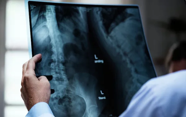 Spine Fixation Surgery