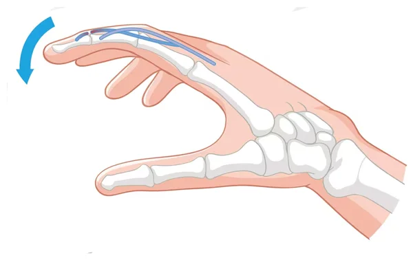 Deformity Correction Surgery